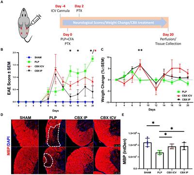 Carbenoxolone mitigates extensive fibrosis formation in PLP-induced EAE model and multiple sclerosis serum-exposed pericyte culture